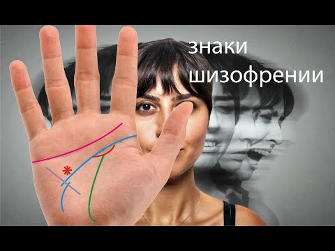 Видео: Хиромантия. Знаки шизофрении