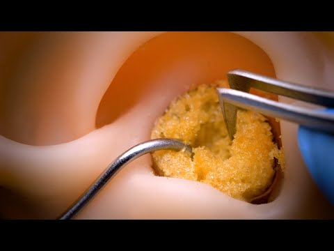 Видео: [ASMR] Наконец-то я нашел звуки, близкие к настоящей чистке ушей. [ACMP]