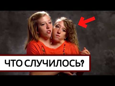 Видео: Вы Уже Слышали, ЧТО Происходит с Сиамскими Близнецами Эбби и Бриттани? #2