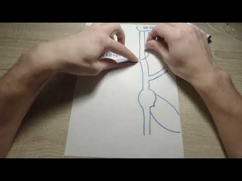 Видео: Как перенаправить проводник из яремной вены в верхнюю полую вену.