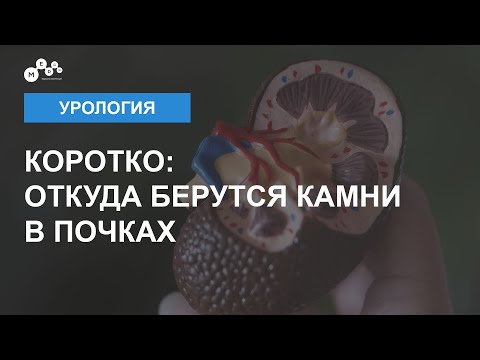 Видео: Камни в почках причины | Мочекаменная болезнь