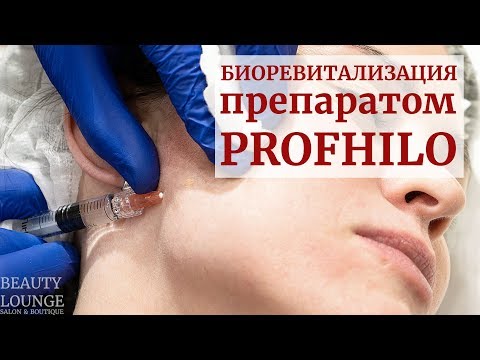 Видео: Биоревитализация препаратом profhilo. Безболезненные инъекции