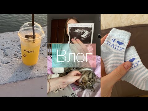 Видео: 36 недель | Приём в ЖК | Многоводье | Гольфный шар | Про Гидросальпинкс