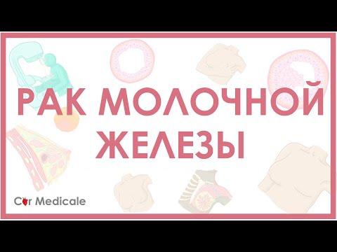 Видео: Рак молочной железы