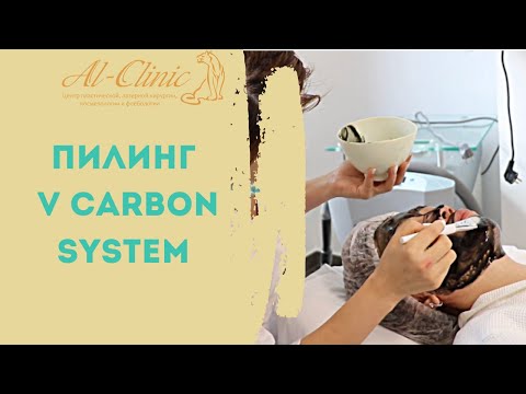 Видео: ПИЛИНГ V CARBON SYSTEM | Всесезонная каброновая пилинг-система!