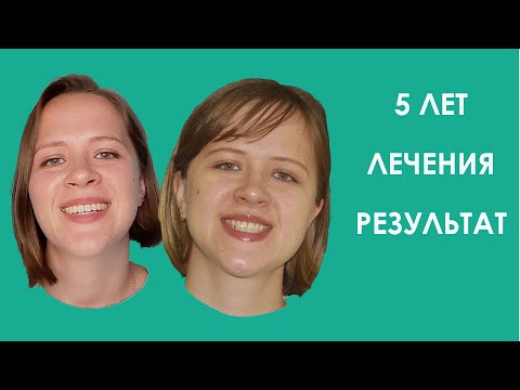 Видео: 5 лет лечения. РЕЗУЛЬТАТЫ. АНОНС ВСТРЕЧИ