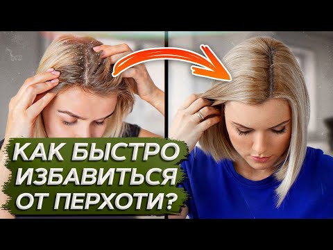 Видео: Откуда ПОЯВЛЯЕТСЯ перхоть и как от нее быстро ИЗБАВИТЬСЯ?