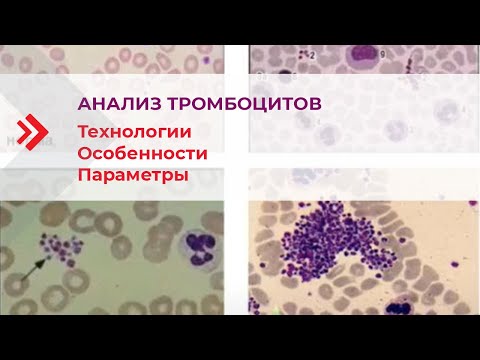 Видео: Анализ тромбоцитов – технологии,  особенности и параметры