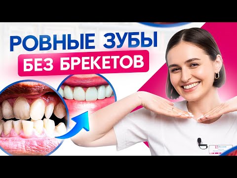 Видео: Можно ли выровнять зубы БЕЗ брекетов? (многие не знают об этом!)