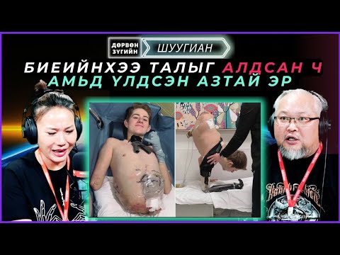Видео: Дөрвөн зүгийн шуугиан | 2025-03-18 | Биеийнхээ талыг алдсан ч амьд үлдсэн азтай эр