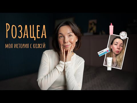 Видео: Розацеа: красная кожа на всю жизнь? Моя история и как я изменила всё!