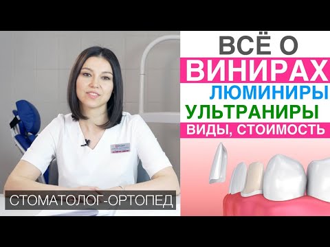 Видео: Виниры - виды, цена, установка виниров для зубов, гарантия. Ультраниры, люминиры, компониры