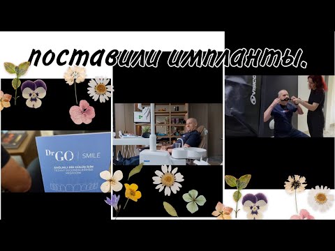 Видео: Клиника в в Стамбуле / GO/ поставили импланты/ что произошло 🤷🏻