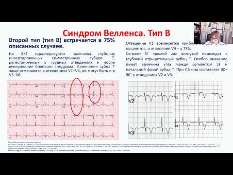 Видео: ЭКГ-признаки окклюзирующих и прогностически неблагоприятных поражений коронарных артерий