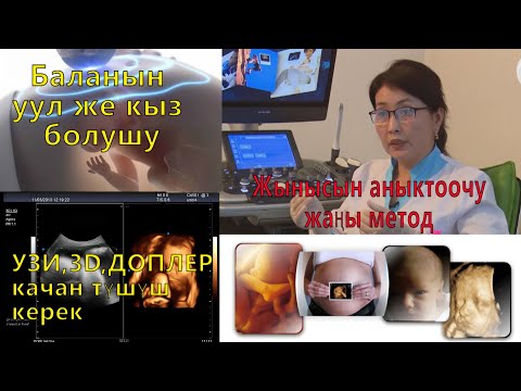 Видео: УЗИ, 3D, ДОПЛЕРге качан түшүш керек? Баланын жынысын аныктоочу жаңы метод!
