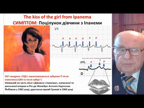 Видео: Chapter-4: Суправентрикулярні тахіаритмії. ЕКГ-діагностика. #proECG