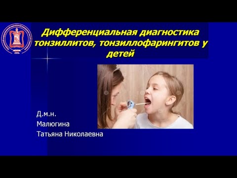 Видео: Дифференциальная диагностика тонзиллитов, тонзиллофарингитов у детей