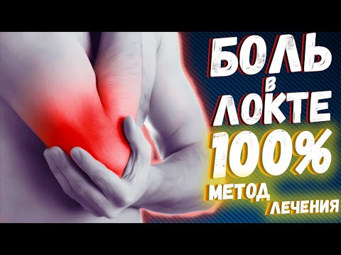 Видео: Болит локоть. Варианты лечения.