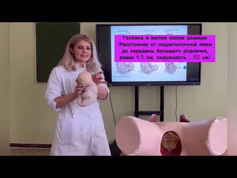 Видео: Акушерские термины. Биомеханизм родов при переднем виде затылочного предлежания