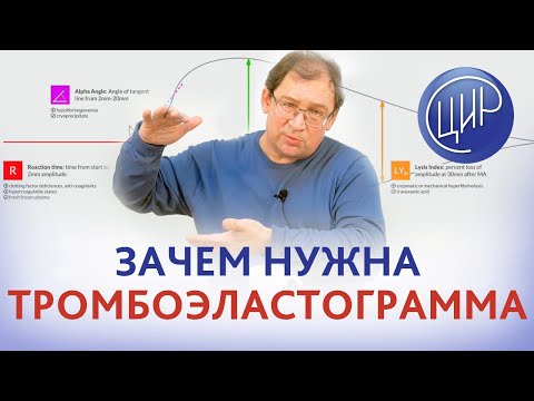 Видео: Тромбоэластограмма. Зачем нужна тромбоэластограмма. Рассказывает Гузов И.И.
