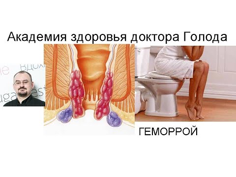 Видео: Геморрой и его лечение.