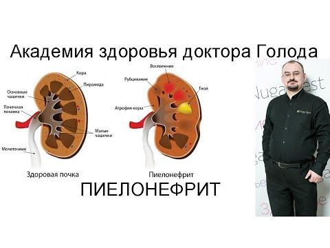 Видео: Пиелонефрит – воспаление в почках.