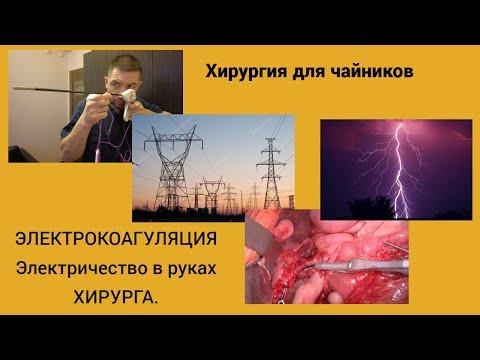 Видео: Хирургия для чайников. Электричество в руках хирурга.