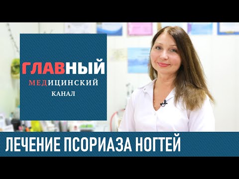 Видео: Псориаз ногтей: симптомы и лечение. Как и чем лечить псориаз на ногтях