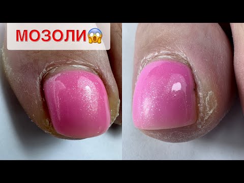 Видео: ПЕДИКЮР ОНЛАЙН. Виктория Авдеева