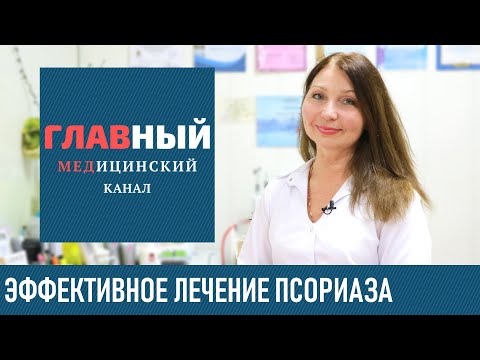 Видео: Лечение псориаза в домашних условиях. Народные средства от псориаза. Как вылечить псориаз