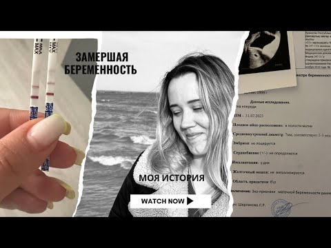 Видео: Беременность, замершая и вакуум-аспирация: моя история