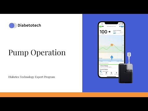 Видео: Эксплуатация инсулиновой помпы | Tandem Mobi Insulin Pump | Diabetotech