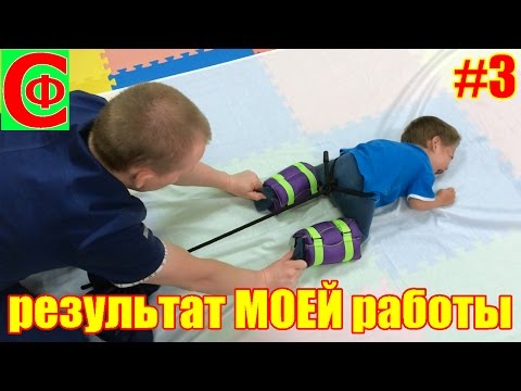 Видео: Лечение ДЦП. Результат МОЕЙ работы. Фролков С.В.