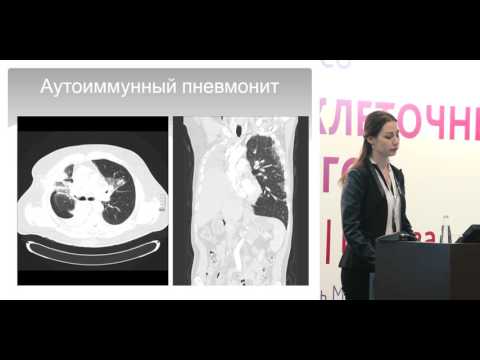 Видео: Иммуноопосредованные нежелательные реакции при лечении больных НМРЛ