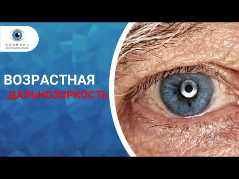Видео: Пресбиопия (возрастная дальнозоркость) - причины и коррекция (лечение)