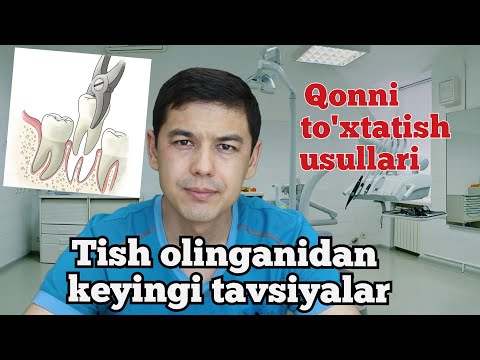 Видео: TISH OLINGANIDAN KEYINGI TAVSIYALAR / Тиш олинганидан кейинги тавсиялар