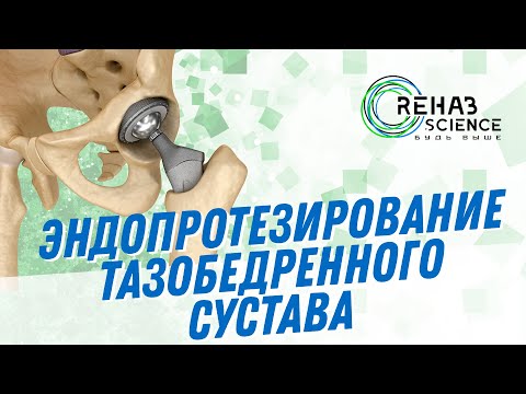 Видео: Эндопротезирование тазобедренного сустава: Протокол реабилитации