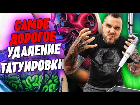 Видео: Сколько стоит удаление тату? / Самое дорогое выведение тату!
