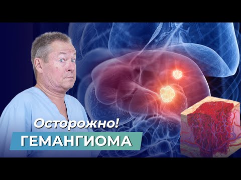 Видео: Осторожно! Нужно ли УДАЛЯТЬ ГЕМАНГИОМУ?