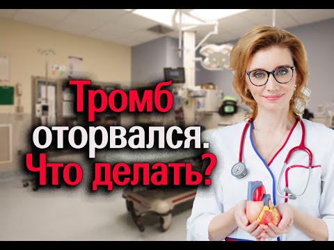 Видео: Тромб оторвался. Что делать? Кардиолог. Москва.