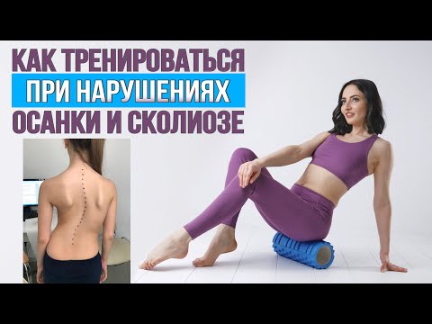 Видео: Тренировки при сколиозе и нарушениях осанки | Что можно делать, а что нет? С ПРИМЕРАМИ