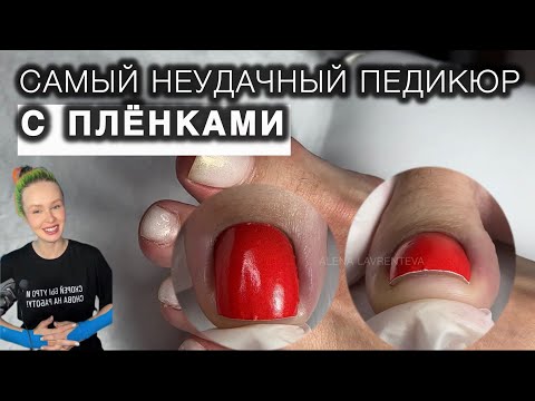 Видео: ПОЧЕМУ ПЛЁНКИ НЕ ПРИКЛЕИЛИСЬ. Неудачный педикюр #аленалаврентьева #педикюр #пленкивпедикюре