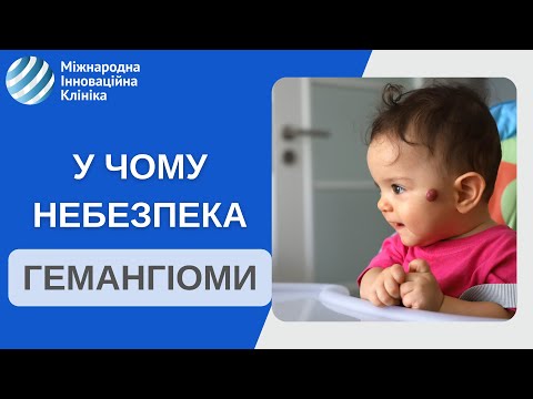 Видео: Гемангиома у новорожденных.