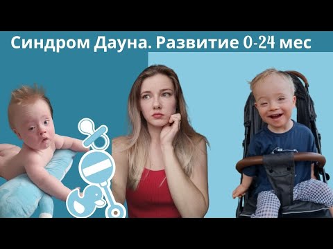 Видео: Синдром Дауна: не ползает, не ходит в два года😔