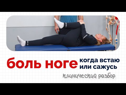 Видео: "Боль в ноге когда встаю или сажусь" | Клинический разбор