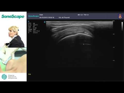 Видео: Мастер-класс на аппарате SonoScape S40Exp. Лектор: Салтыкова В.Г.