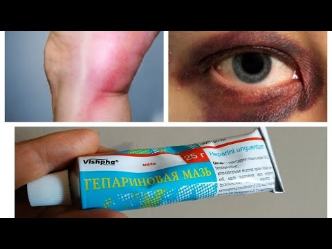 Видео: ГЕПАРИНОВАЯ МАЗЬ от морщин, синяков, мешков под глазами. Что важно знать про гепариновую мазь?