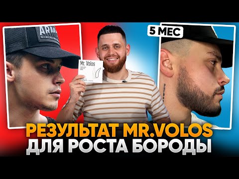 Видео: БОРОДА С НУЛЯ ЗА 5 МЕСЯЦЕВ в 24 года / Результаты лосьона mr.Volos для роста бороды