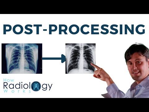 Видео: Постобработка рентгеновских снимков (фильтры, гистограммы, объекты интереса)