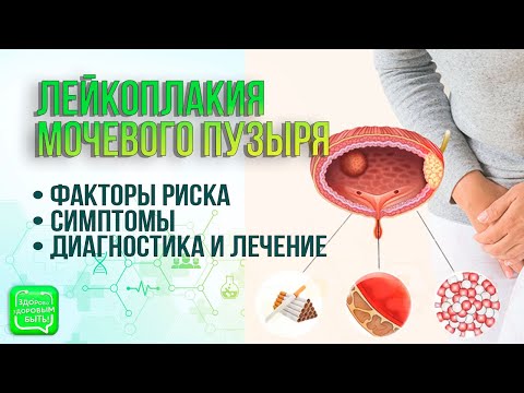 Видео: Лейкоплакия мочевого пузыря | Здорово здоровым быть